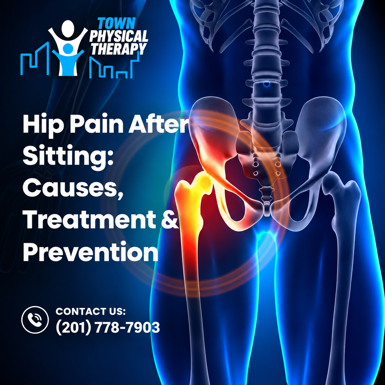 Hip Pain After Sitting